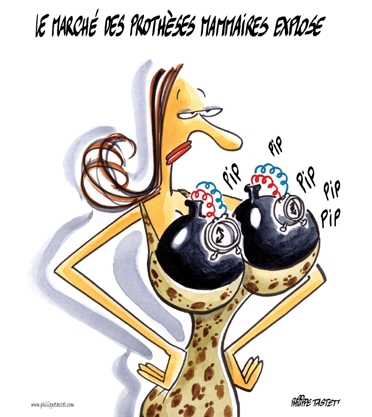 dessin : Le marché des prothèses mammaires explose